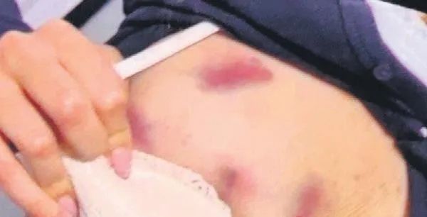 Antalya Büyükşehir Belediyesi'nde şok iddia: Meclis üyesi Taylan Şanlı, genç kadına korku dolu anlar yaşattı! 3