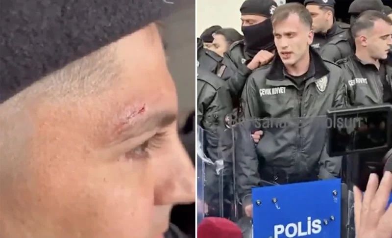 Yolsuzluğun öfkesini polisten çıkardılar: Bursa'da CHP'li grup emniyet güçlerini yaraladı! 1