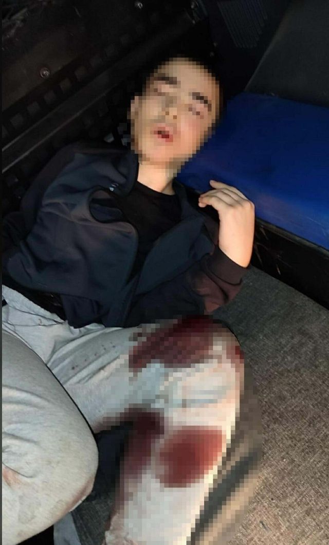 3 polisimizi şehit eden 16'lık teröristten kan donduran itiraflar! "DEAŞ'ı seviyorum, ailem kafir! Bomba yapmayı internetten öğrendim" 7