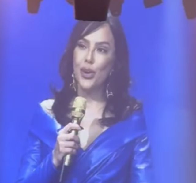 Ebru Gündeş itiraf etti! "Yüzümü gerdirdim": İşte son hali... 3