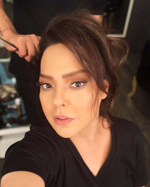 Ebru Gündeş itiraf etti! "Yüzümü gerdirdim": İşte son hali... 2
