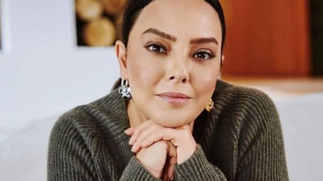Ebru Gündeş itiraf etti! "Yüzümü gerdirdim": İşte son hali... 4