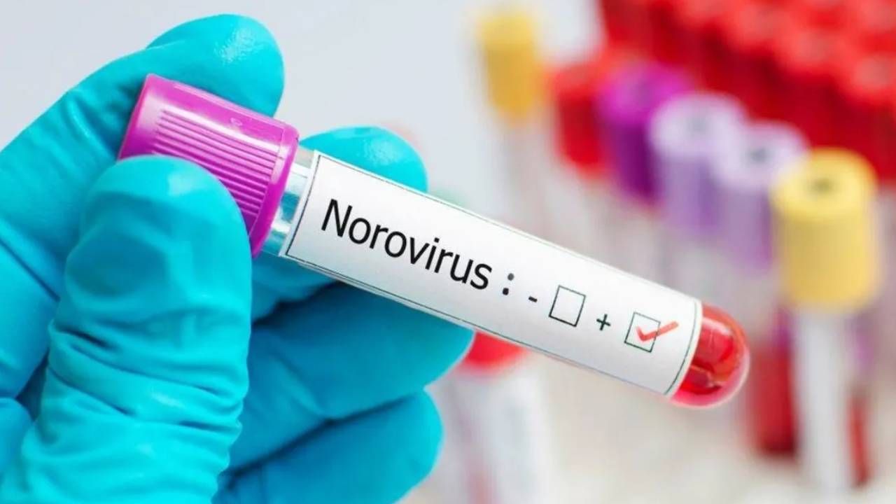 1 ay boyunca vücutta saklanıyor! Dezenfekten bile durduramıyor: İşte Norovirüs hakkında tüm bilinmeyenler 7