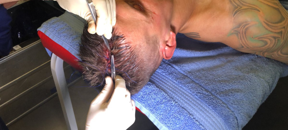 Skrtel'den büyük fedakarlık!