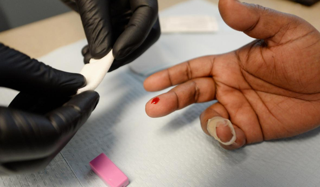 Eşcinsel FETÖ imamı AIDS testinde yakalandı!