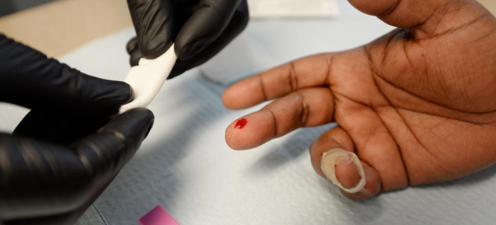 Eşcinsel FETÖ imamı AIDS testinde yakalandı!