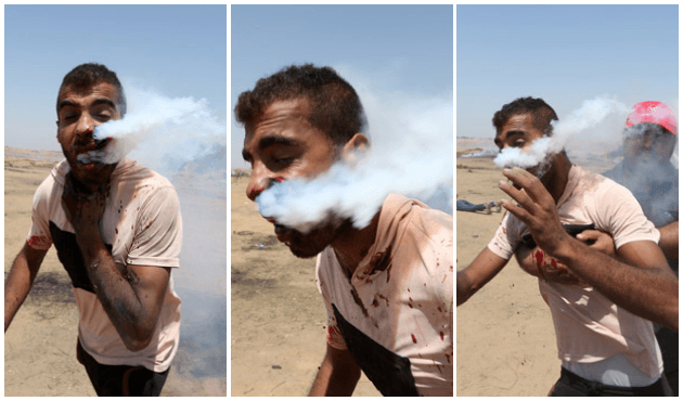 Filistinli genci gaz fişeği ile yüzünden vurdular!