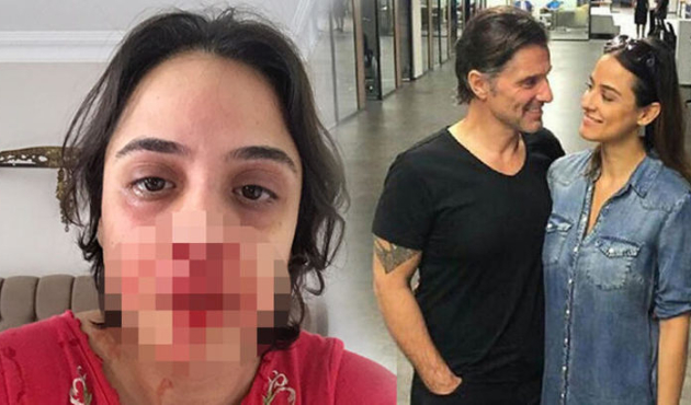 Hazım Körmükçü nişanlısını bu hale getirdi!