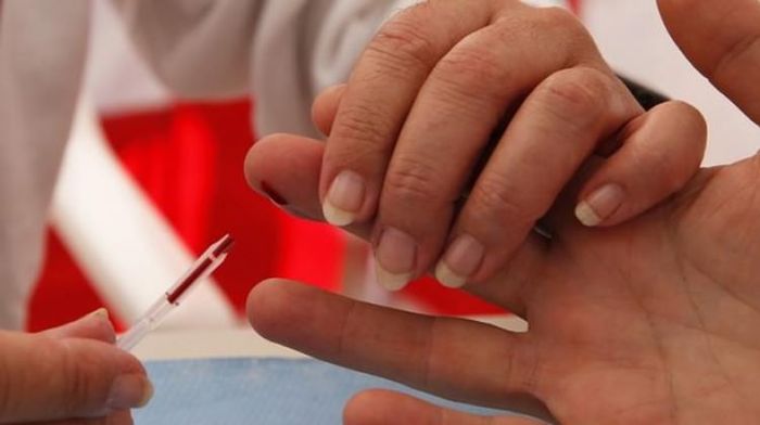 Bilim insanları açıkladı: AIDS alt edildi