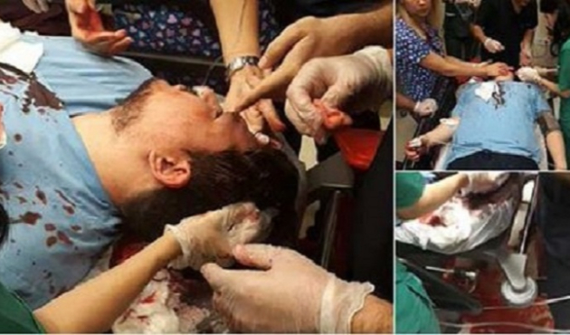 Doktorun kafasında kaldırım taşı kırdılar!