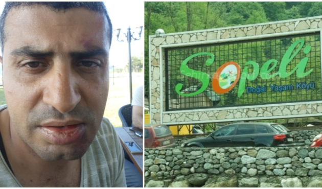 15 Temmuz'un kahraman doktoruna öldüresiye dayak!
