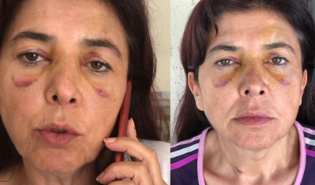 Emekli polise dehşeti yaşattılar!