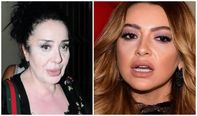 Hadise özür bekleyen Nur Yerlitaş'a patladı!