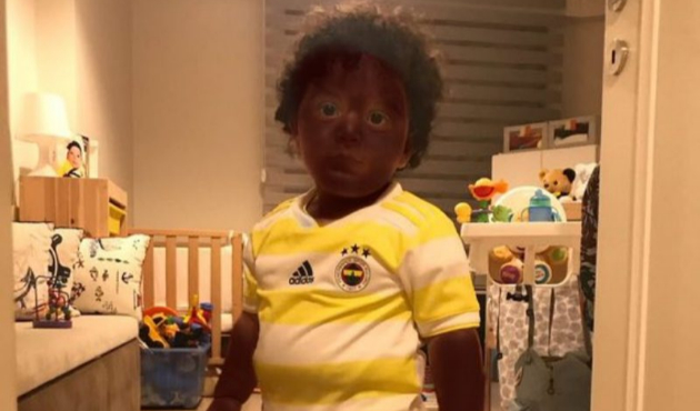 Sissoko geliyor diye oğlunu siyaha boyadı!