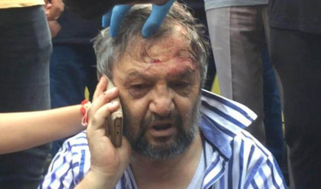 Bursa'da "teknik aksaklık" dayağı