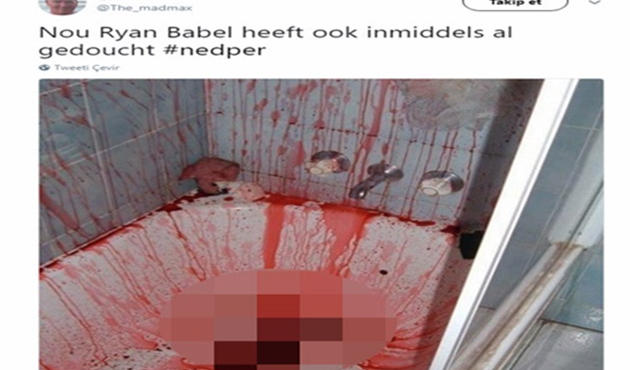 Beşiktaşlı yıldızla ilgili dehşete düşüren paylaşım!