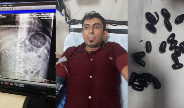 Midesinden 30 kapsül uyuşturucu çıktı...
