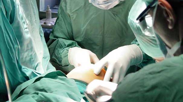 Flaş... Ünlü cerrahlara gözaltı! İlk yüz nakilini yapan ekipten bir isim de var...