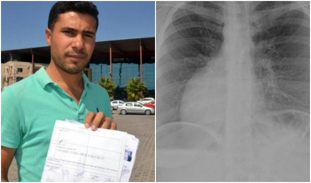 Rapor almaya gitti, kalbinin atmadığını öğrendi!