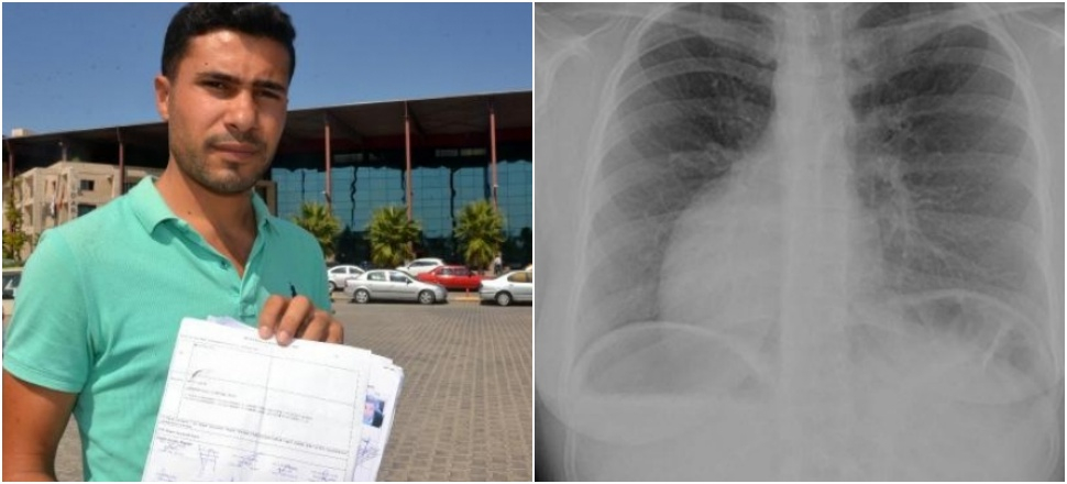 Rapor almaya gitti, kalbinin atmadığını öğrendi!