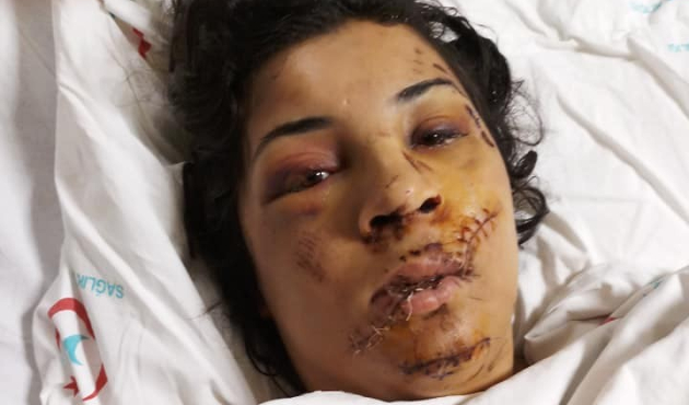 Eski eşinin yüzünü şişeyle parçaladı!