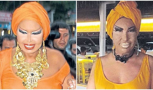 Bülent Ersoy'a benzemek için onlarca ameliyat geçirdi!