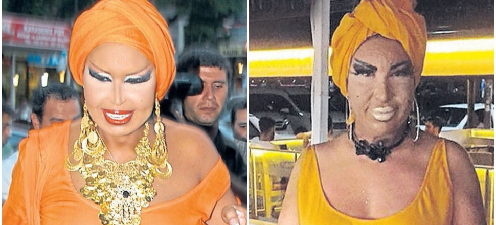 Bülent Ersoy'a benzemek için onlarca ameliyat geçirdi!