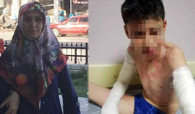 Komşu dehşeti! Anne ve çocuklarını kezzapla yaktı