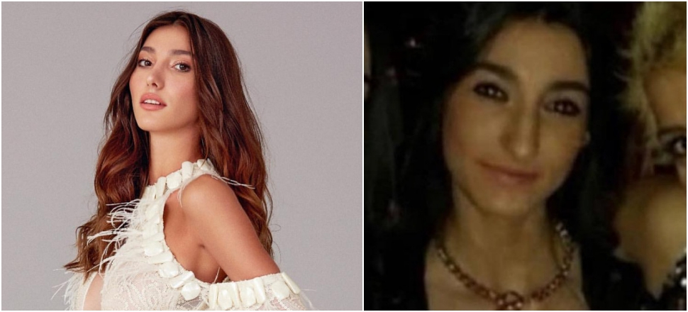 Miss Turkey jürisinden estetik açıklaması!