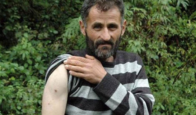 Kendisine saldıran ayıya yumruk atıp kurtuldu!