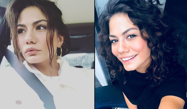 Botokslular kervanına Demet Özdemir de katıldı!