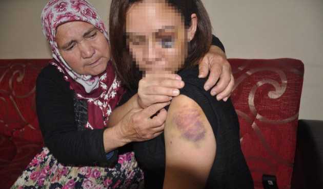 Uykusunda sayıkladığı için bu hale getirildi!