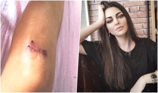 Sinem Umaş'ın polisle içki kavgası!