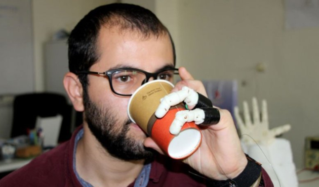İki parmağı kopunca protez yaptı!