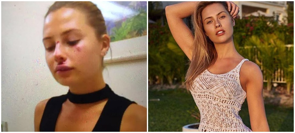Chloe Ortaç'ın kaza yapma sebebi nazar değil alkol çıktı!