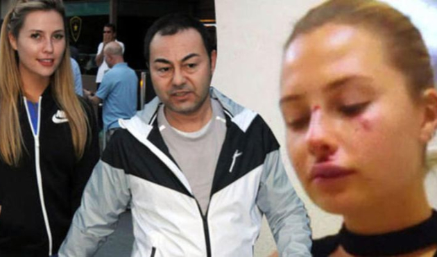 "Chloe motordan düşmedi" deyip gerçeği açıkladı!