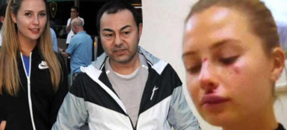 "Chloe motordan düşmedi" deyip gerçeği açıkladı!