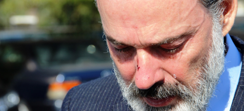 "Ben namuslu bir adamım, eşim beni darp ettirdi!"