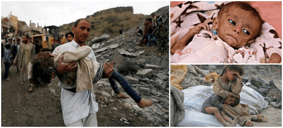 Türkiye Yemen'de ölen çocuklar için ayakta!