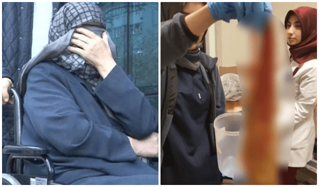 Hastaneye yatan kadının karnından çıkardılar!