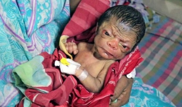 İşte gerçek Benjamin Button!