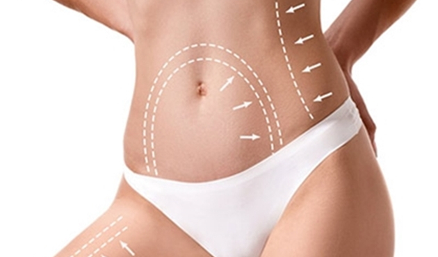 Liposuction kilo vermek için kullanılmaz