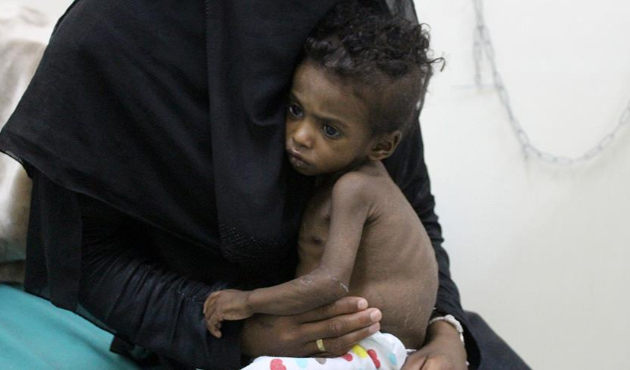 Yemen'de kıtlık en çok çocukları vuruyor