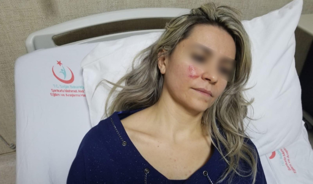 Şanlıurfa'da hastası, kadın doktoru darp etti...