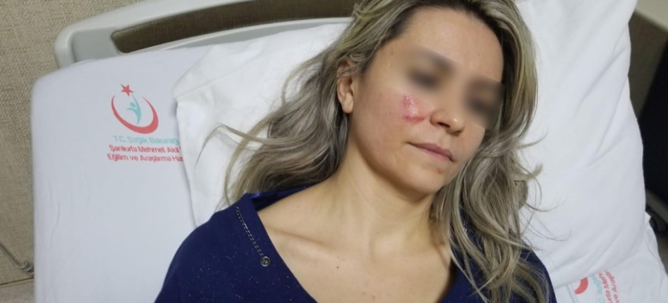 Şanlıurfa'da hastası, kadın doktoru darp etti...