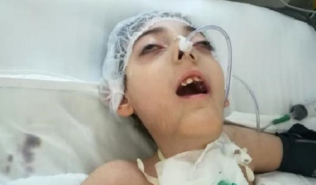 Yalova'da Arda'nın solunum cihazına ihtiyacı var
