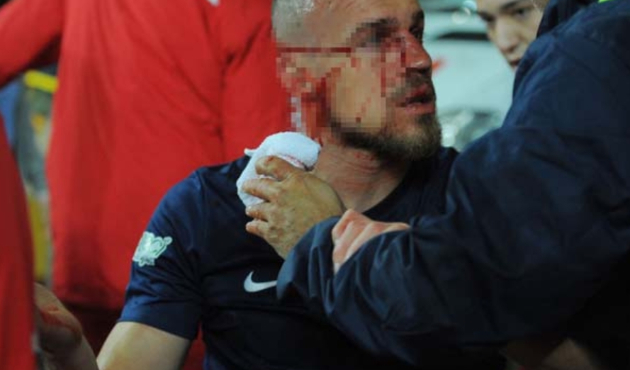 Antalya'da korkutan sakatlık!