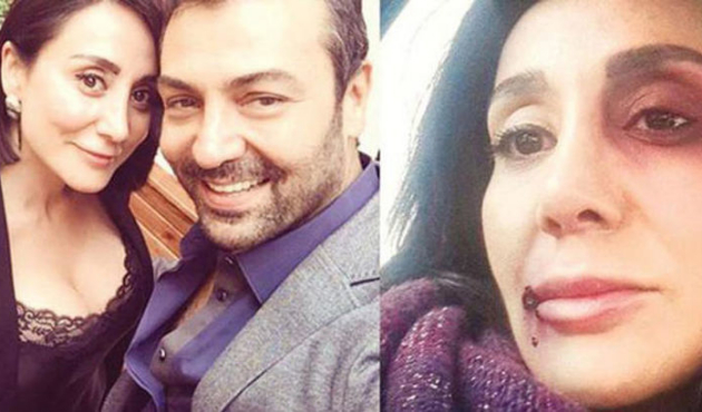Saruhan Hünel'in darp davasında 'rapor' detayı!