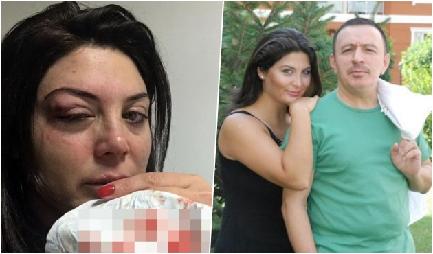 "Bana vurdu ama o vurmadığını iddia ediyor!"