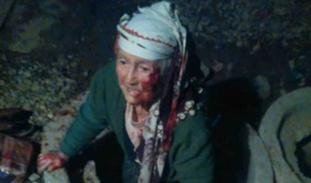 Denizli'de yaşlı kadın görünmez kaza geçirdi